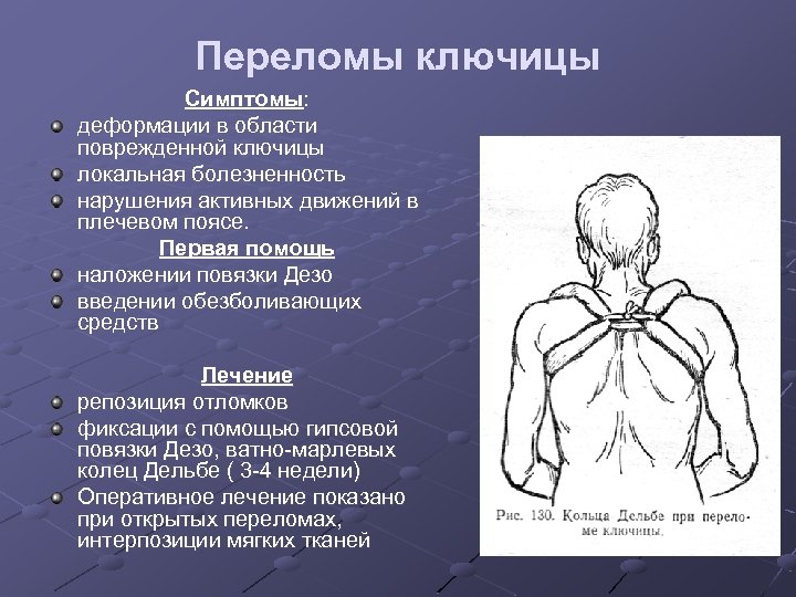 Переломы ключицы Симптомы: деформации в области поврежденной ключицы локальная болезненность нарушения активных движений в