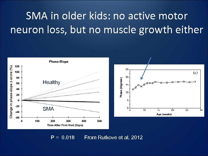 SMA in older kids: no active motor neuron loss, but no muscle growth either