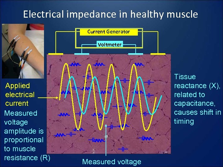 Electrical impedance in healthy muscle Current Generator Voltmeter Applied electrical current Measured voltage amplitude