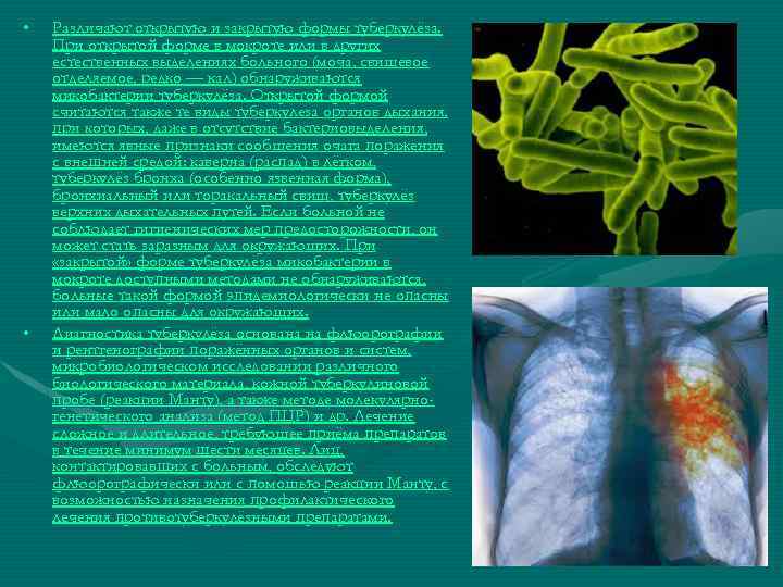  • • Различают открытую и закрытую формы туберкулёза. При открытой форме в мокроте
