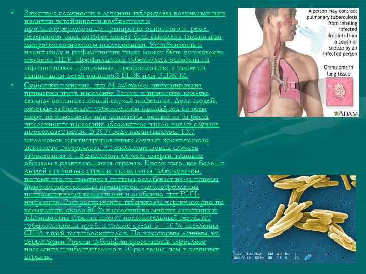  • • Заметные сложности в лечении туберкулёза возникают при наличии устойчивости возбудителя к