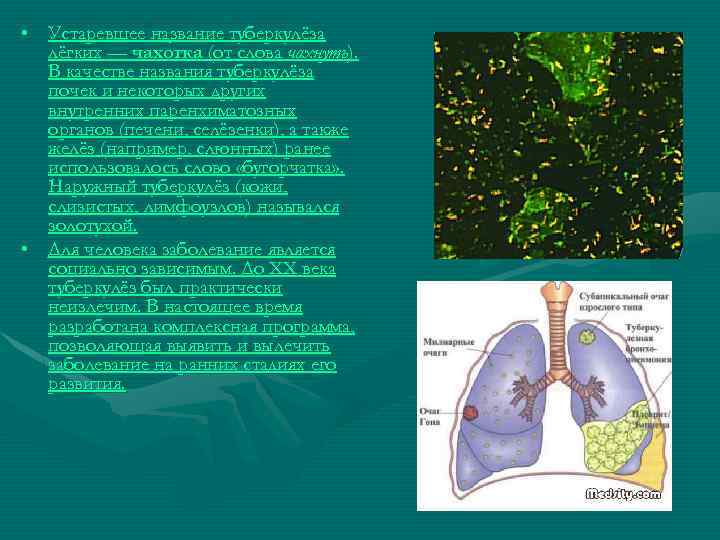  • Устаревшее название туберкулёза лёгких — чахо тка (от слова чахнуть). тка В