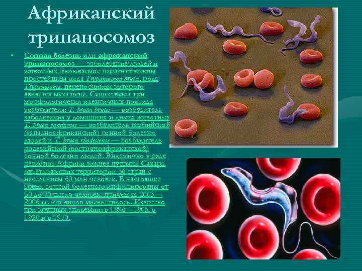 Африканский трипаносомоз • Сонная болезнь или африканский трипаносомоз — заболевание людей и животных, вызываемое