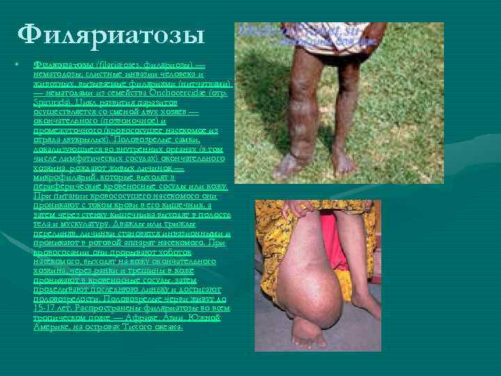 Филяриатозы • Филяриатозы (filariatoses, филяриозы) — нематодозы, глистные инвазии человека и животных, вызываемые филяриями