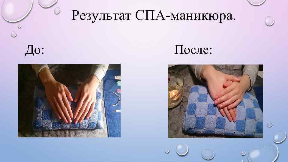 Результат СПА-маникюра. До: После: 