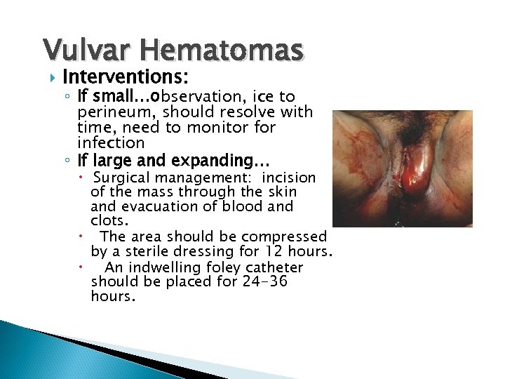 Vulvar Hematomas Interventions: ◦ If small…observation, ice to perineum, should resolve with time, need