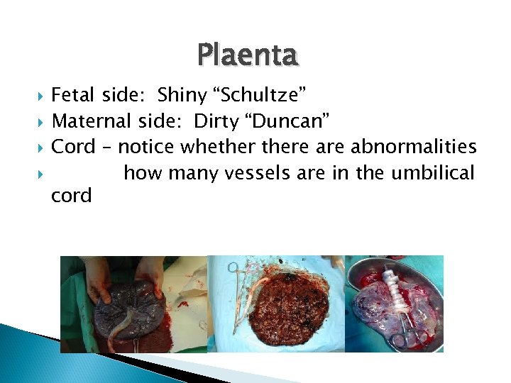 Plaenta Fetal side: Shiny “Schultze” Maternal side: Dirty “Duncan” Cord – notice whethere abnormalities