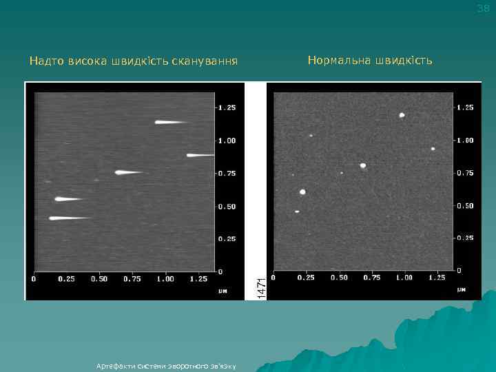 38 Надто висока швидкість сканування Артефакти системи зворотного зв'язку Нормальна швидкість 