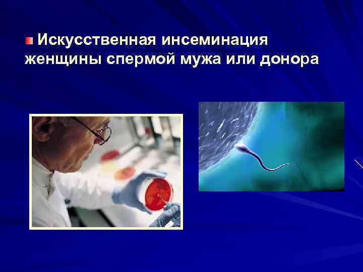  Искусственная инсеминация женщины спермой мужа или донора 