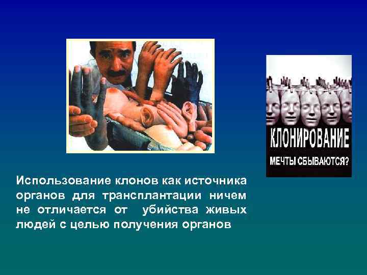 Использование клонов как источника органов для трансплантации ничем не отличается от убийства живых людей