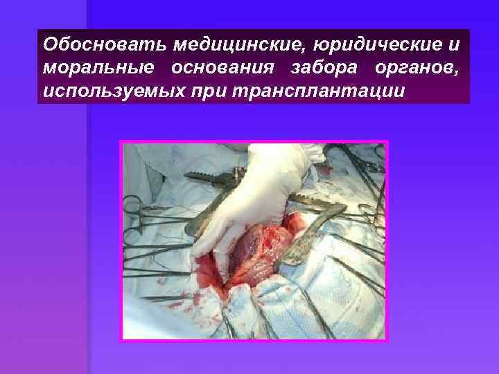 Обосновать медицинские, юридические и моральные основания забора органов, используемых при трансплантации 