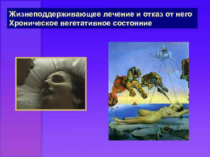 Жизнеподдерживающее лечение и отказ от него Хроническое вегетативное состояние 
