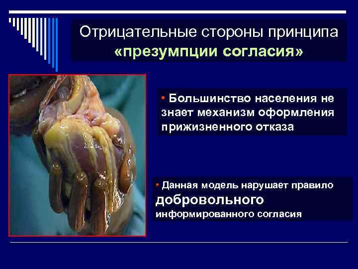 Отрицательные стороны принципа «презумпции согласия» • Большинство населения не знает механизм оформления прижизненного отказа