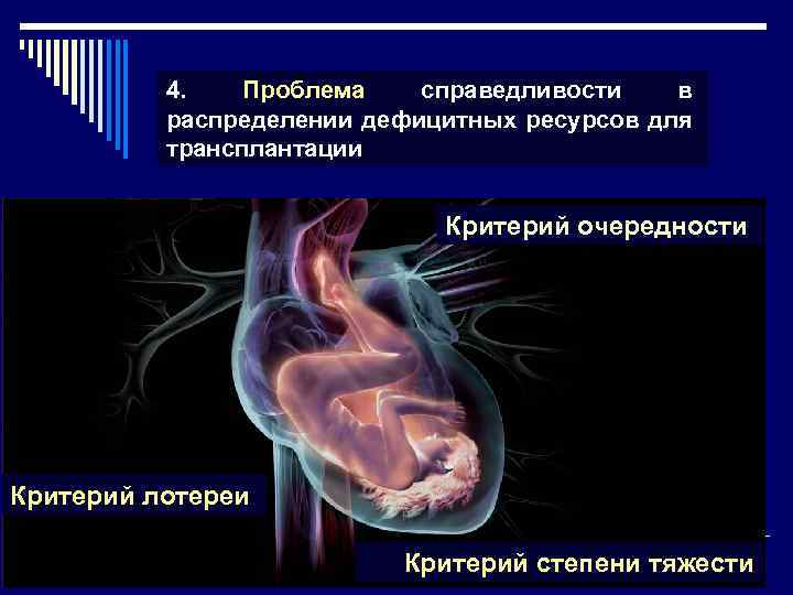 4. Проблема справедливости в распределении дефицитных ресурсов для трансплантации Критерий очередности Критерий лотереи Критерий