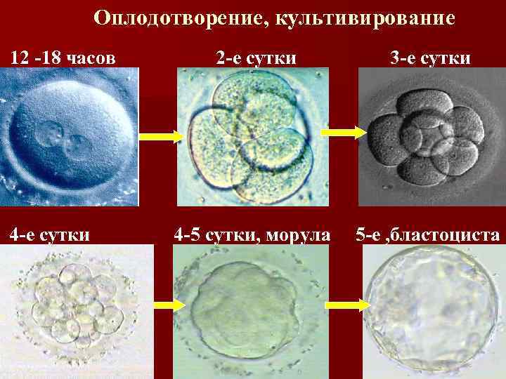 Оплодотворение, культивирование 12 -18 часов 4 -е сутки 2 -е сутки 3 -е сутки