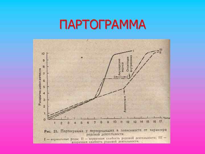 ПАРТОГРАММА 