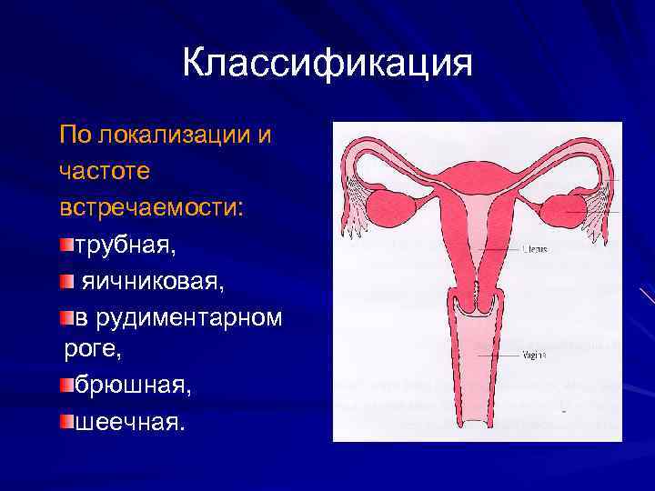 Классификация По локализации и частоте встречаемости: трубная, яичниковая, в рудиментарном роге, брюшная, шеечная. 