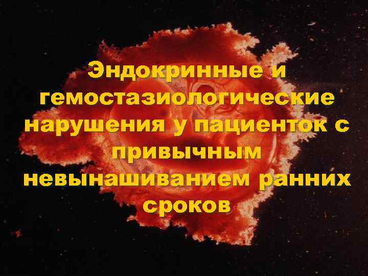 Эндокринные и гемостазиологические нарушения у пациенток с привычным невынашиванием ранних сроков 