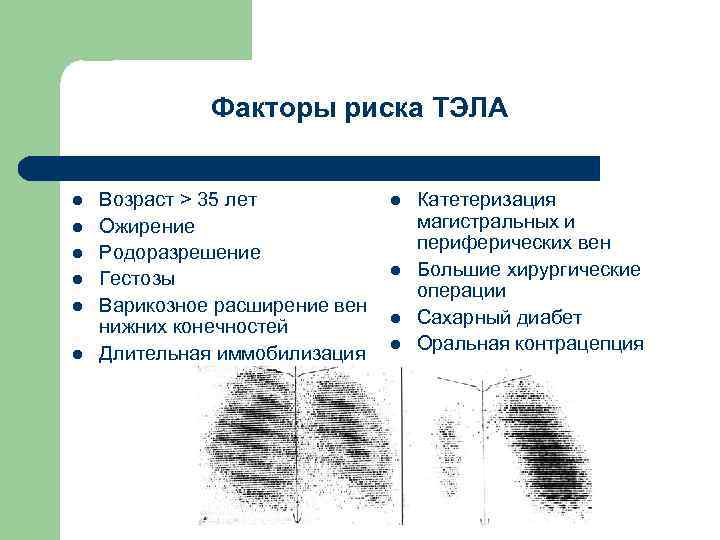 Факторы риска ТЭЛА l l l Возраст > 35 лет Ожирение Родоразрешение Гестозы Варикозное