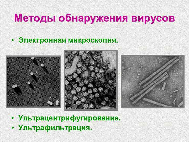 Методы обнаружения вирусов • Электронная микроскопия. • Ультрацентрифугирование. • Ультрафильтрация. 