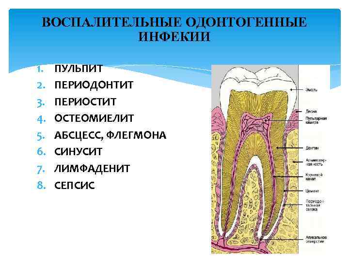 ВОСПАЛИТЕЛЬНЫЕ ОДОНТОГЕННЫЕ ИНФЕКИИ 1. 2. 3. 4. 5. 6. 7. 8. ПУЛЬПИТ ПЕРИОДОНТИТ ПЕРИОСТИТ