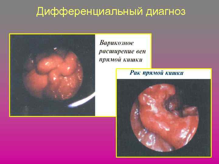 Дифференциальный диагноз 