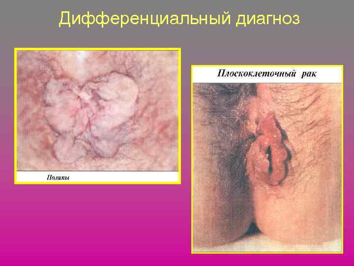 Дифференциальный диагноз 