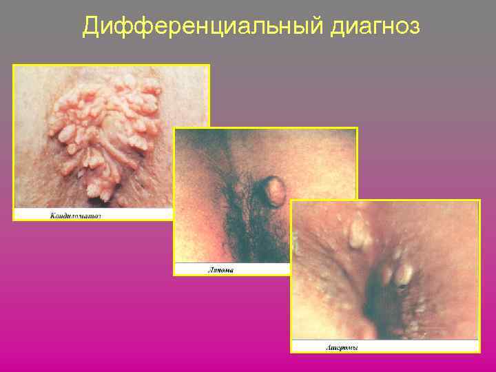 Дифференциальный диагноз 