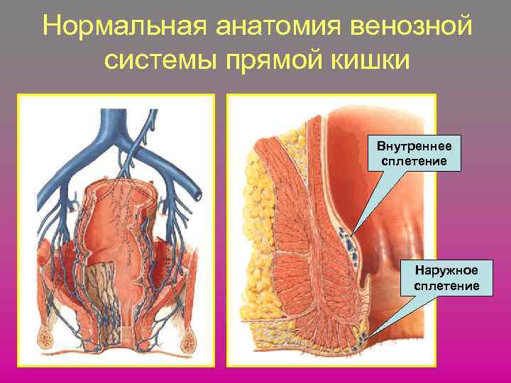 Нормальная анатомия венозной системы прямой кишки Внутреннее сплетение Наружное сплетение 