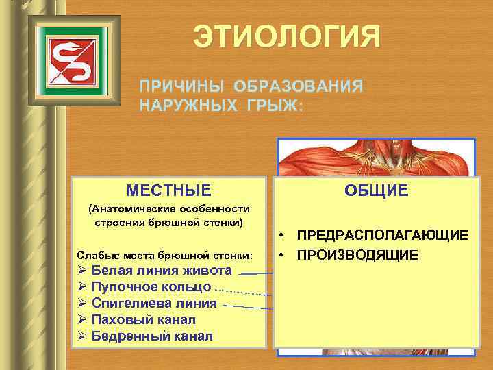 ЭТИОЛОГИЯ ПРИЧИНЫ ОБРАЗОВАНИЯ НАРУЖНЫХ ГРЫЖ: МЕСТНЫЕ (Анатомические особенности строения брюшной стенки) Слабые места брюшной