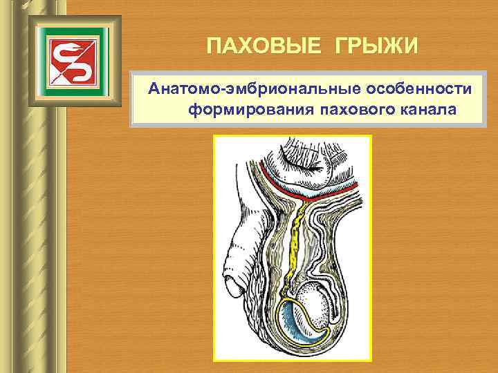 ПАХОВЫЕ ГРЫЖИ Анатомо-эмбриональные особенности формирования пахового канала 