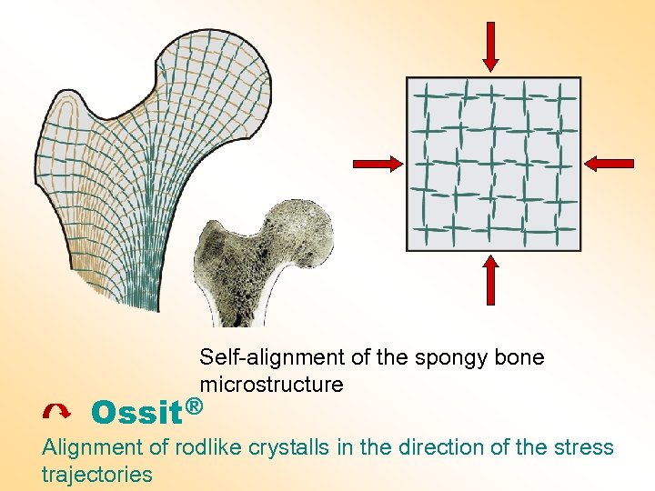 Self-alignment of the spongy bone microstructure Ossit ® Alignment of rodlike crystalls in the