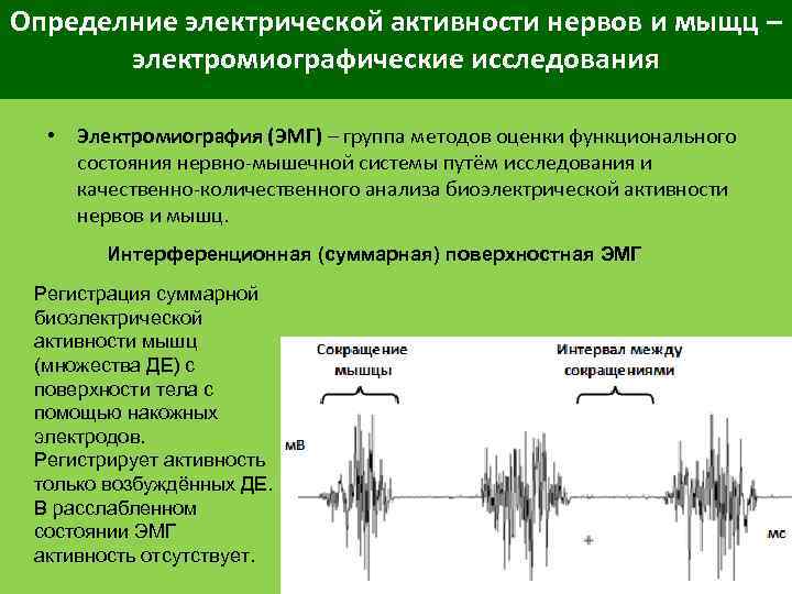Определние электрической активности нервов и мыщц – электромиографические исследования • Электромиография (ЭМГ) – группа