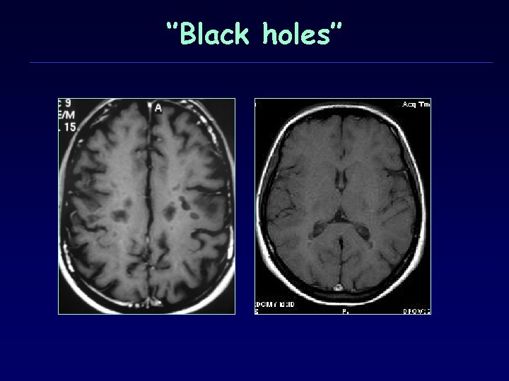 ‘’Black holes’’ 