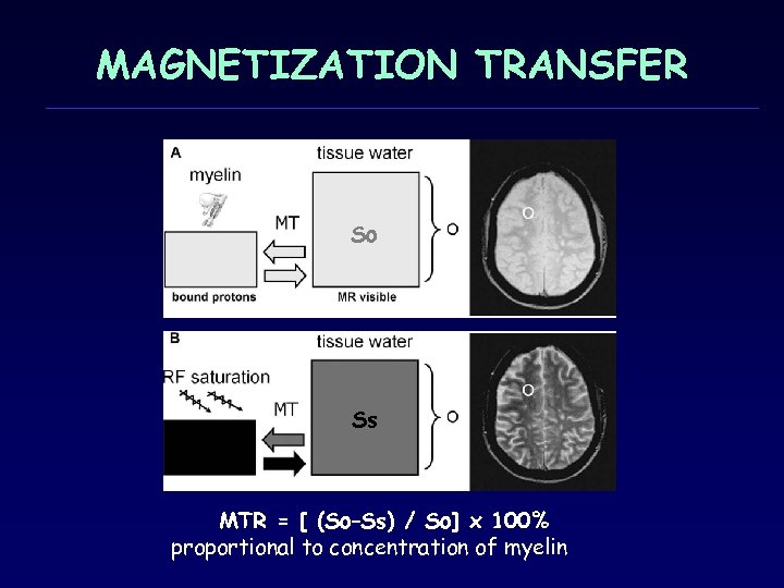 MAGNETIZATION TRANSFER So Ss MTR = [ (So–Ss) / So] x 100% proportional to
