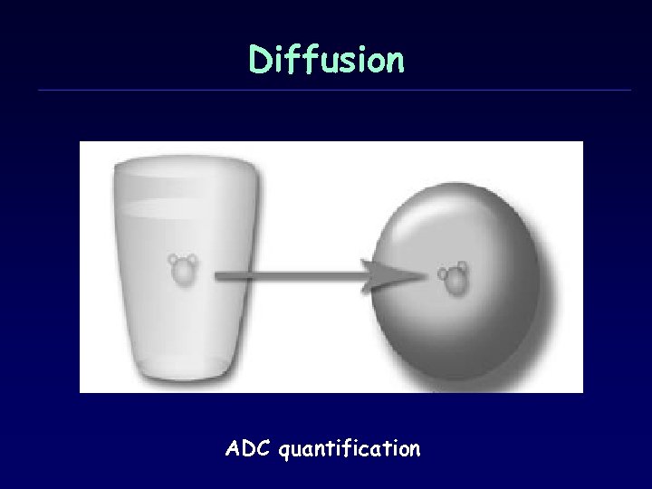 Diffusion ADC quantification 
