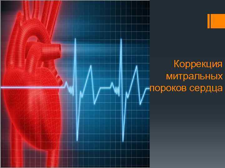 Коррекция митральных пороков сердца 
