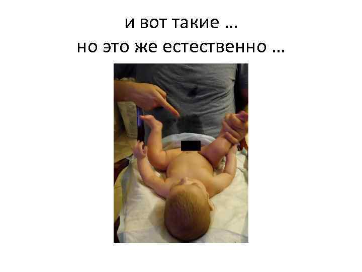 и вот такие … но это же естественно … 