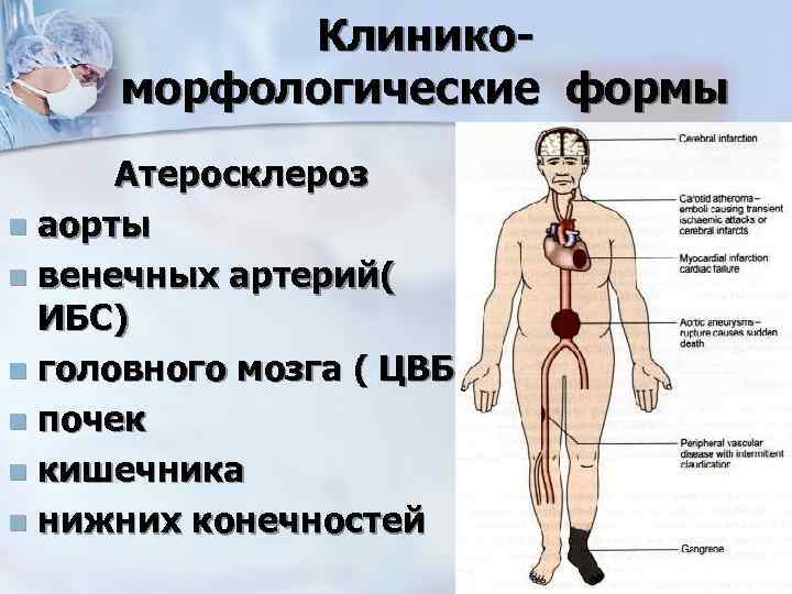 Клиникоморфологические формы Атеросклероз n аорты n венечных артерий( ИБС) n головного мозга ( ЦВБ)