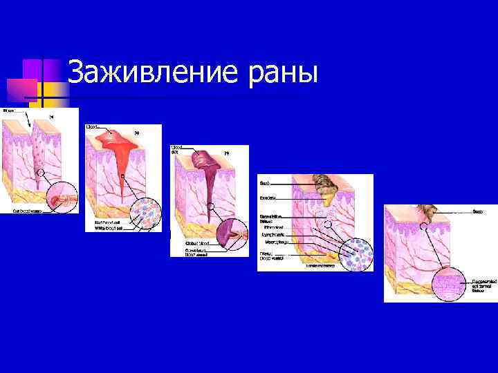 Заживление раны 