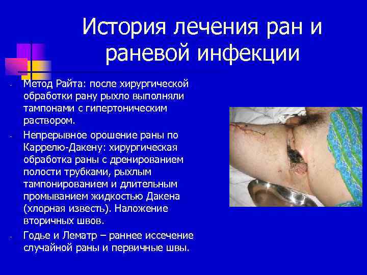 История лечения ран и раневой инфекции - - - Метод Райта: после хирургической обработки
