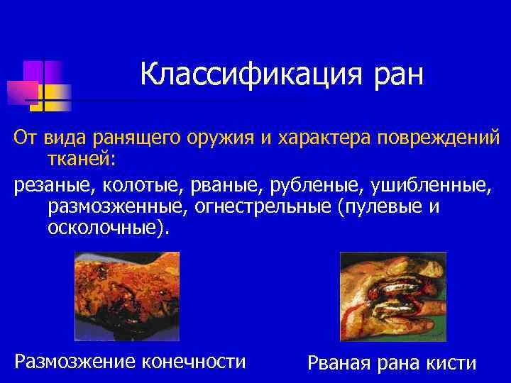 Классификация ран От вида ранящего оружия и характера повреждений тканей: резаные, колотые, рваные, рубленые,