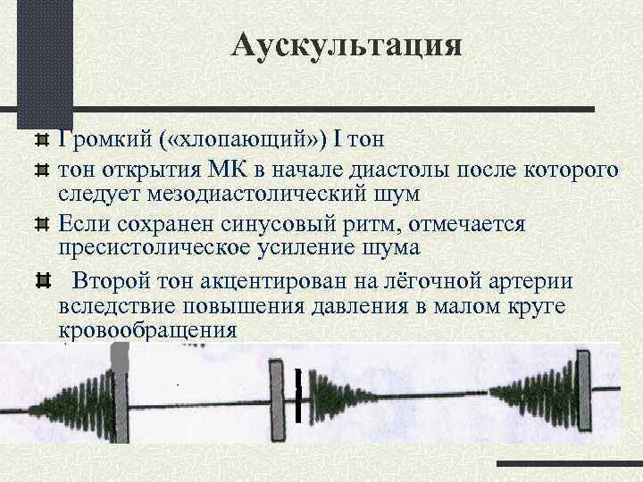 Аускультация Громкий ( «хлопающий» ) I тон открытия МК в начале диастолы после которого