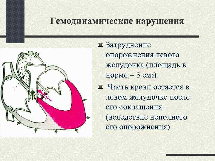 Схема гемодинамики при пороках сердца - 94 фото