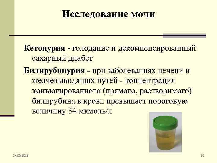 Исследование мочи Кетонурия - голодание и декомпенсированный сахарный диабет Билирубинурия - при заболеваниях печени