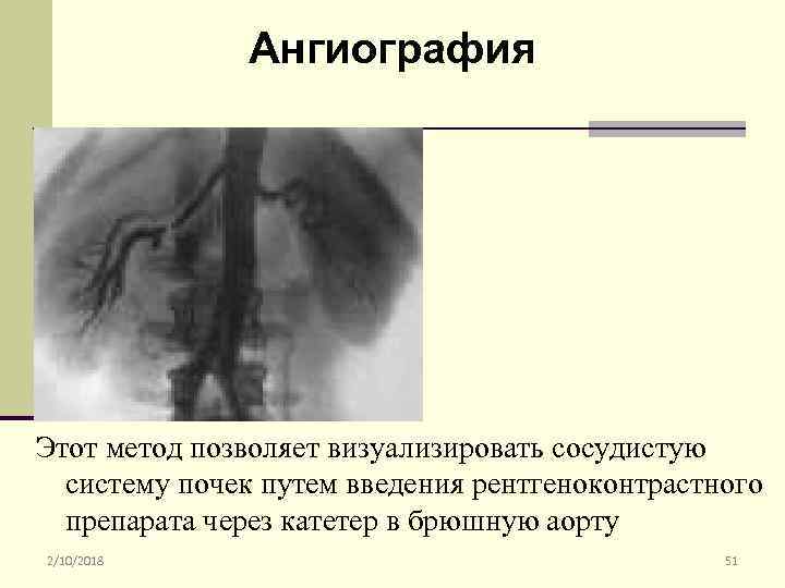 Ангиография Этот метод позволяет визуализировать сосудистую систему почек путем введения рентгеноконтрастного препарата через катетер