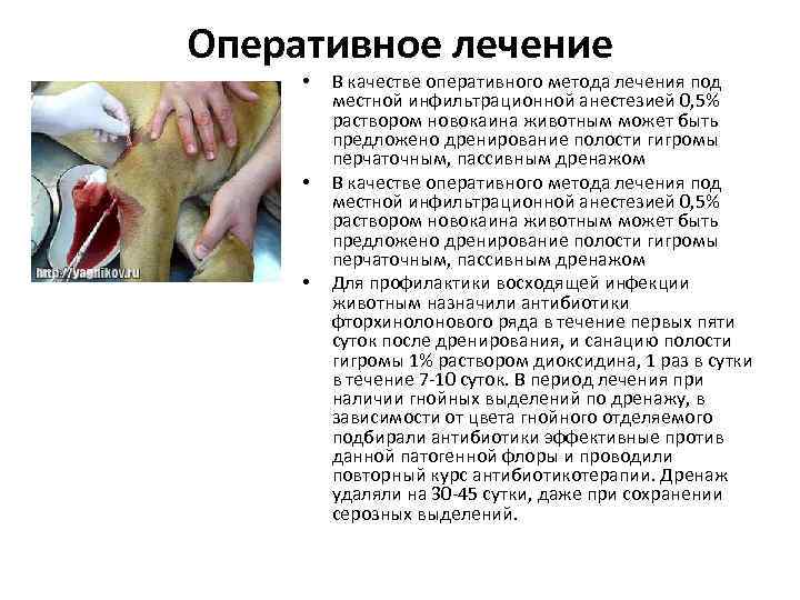 Оперативное лечение • • • В качестве оперативного метода лечения под местной инфильтрационной анестезией