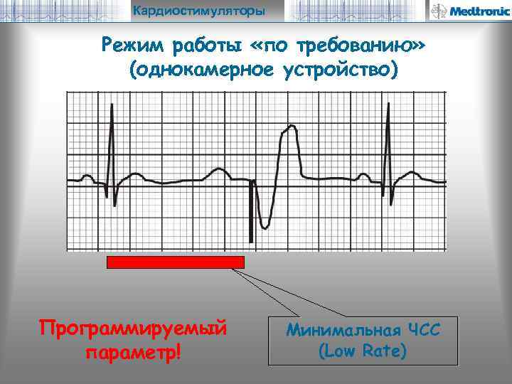 Кардиостимуляторы Режим работы «по требованию» (однокамерное устройство) Программируемый параметр! Минимальная ЧСС (Low Rate) 