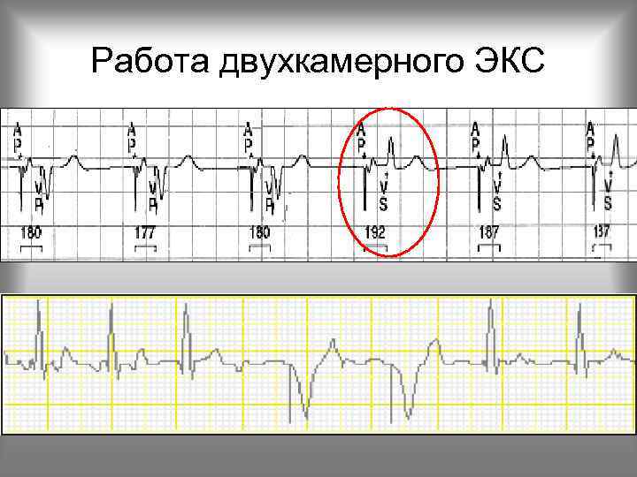 Работа двухкамерного ЭКС 