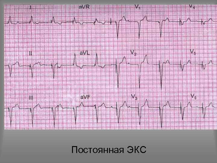 Постоянная ЭКС 